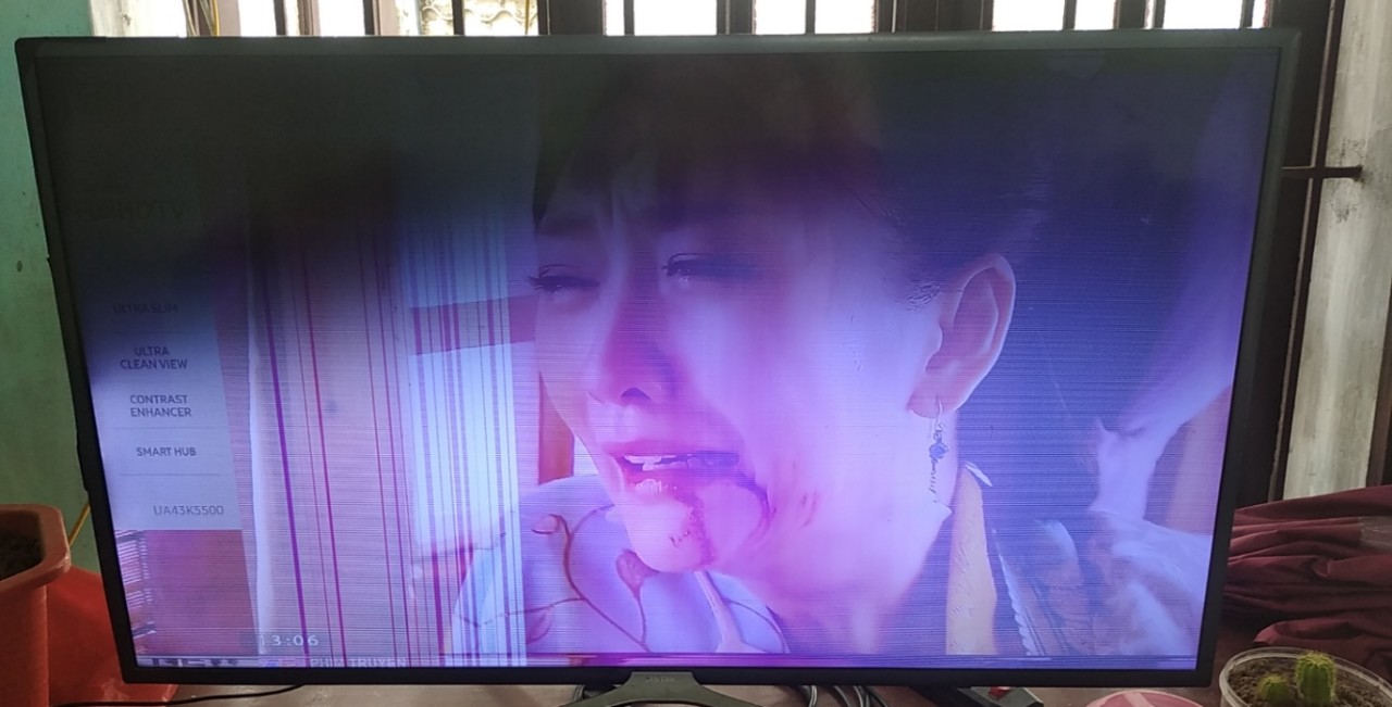 Tivi Xiaomi Hỏng Màn Hình Tivi Xiaomi Hỏng Màn Hình