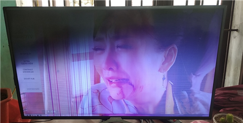 Tivi Xiaomi Hỏng Màn Hình